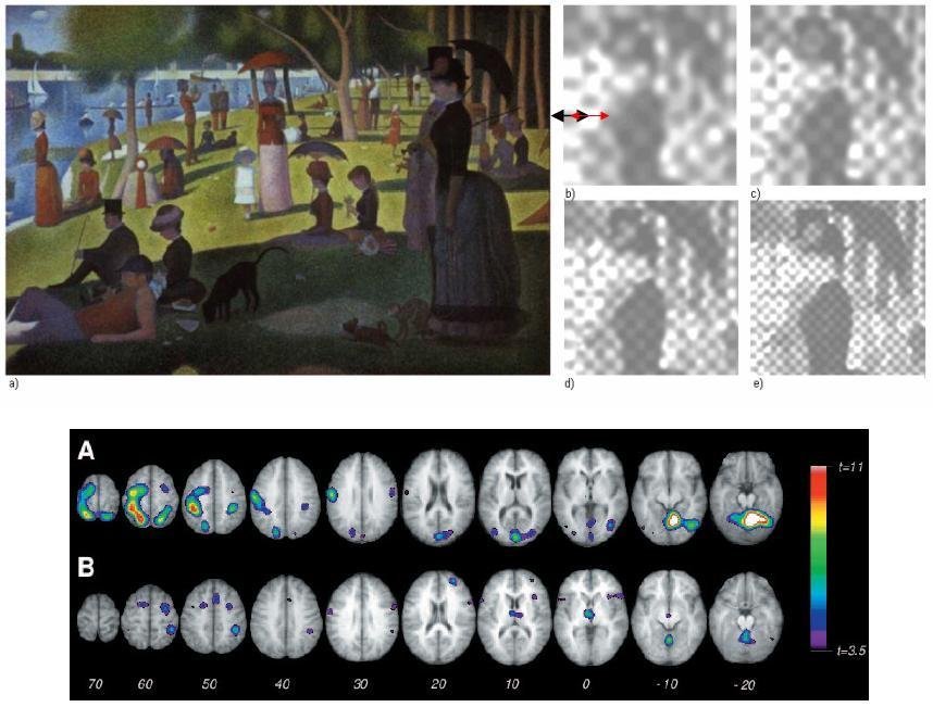 Human Artificial Vision. Prosthesis for the blind.