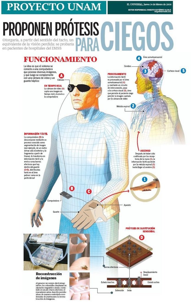 Human Artificial Vision. Prosthesis for the blind.