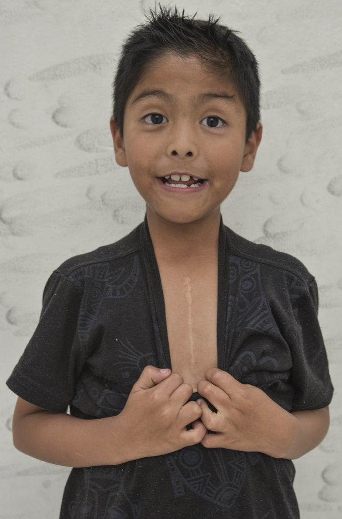 Help a Children's Heart Center Save More Lives