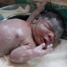 New born baby at Katoka October 2021