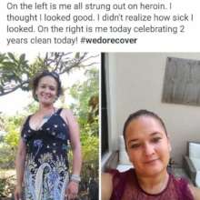 Before/After