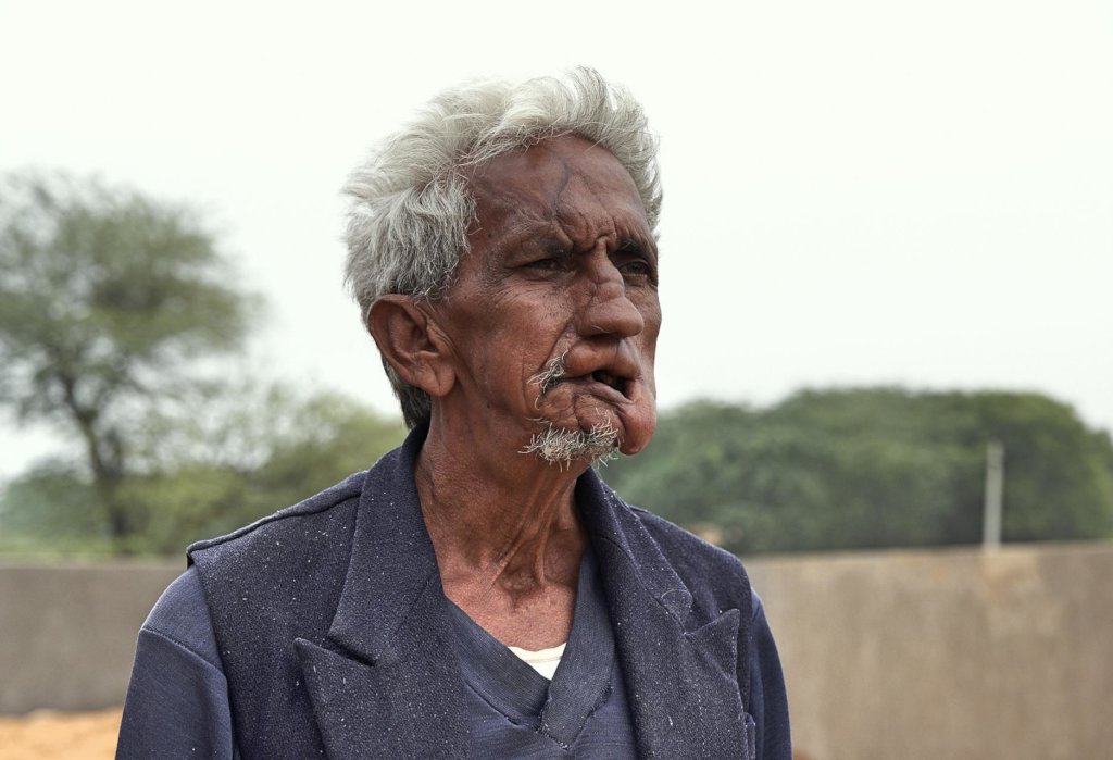 Transforming lives of Disabled Person in India