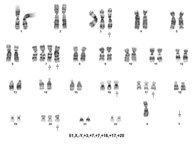 Help 100 Afghans in diagnosis of Blood Cancers