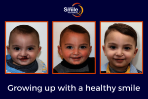 Othman before and after surgery