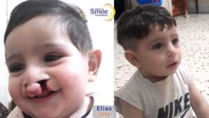 Elias's Smile
