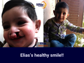 Elias's healthy smile