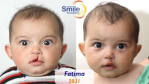 Fatima doing well after her surgery!