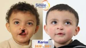 Karim's healthy smile!