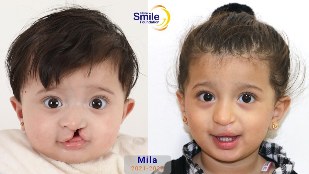 Mila's Health Smile!