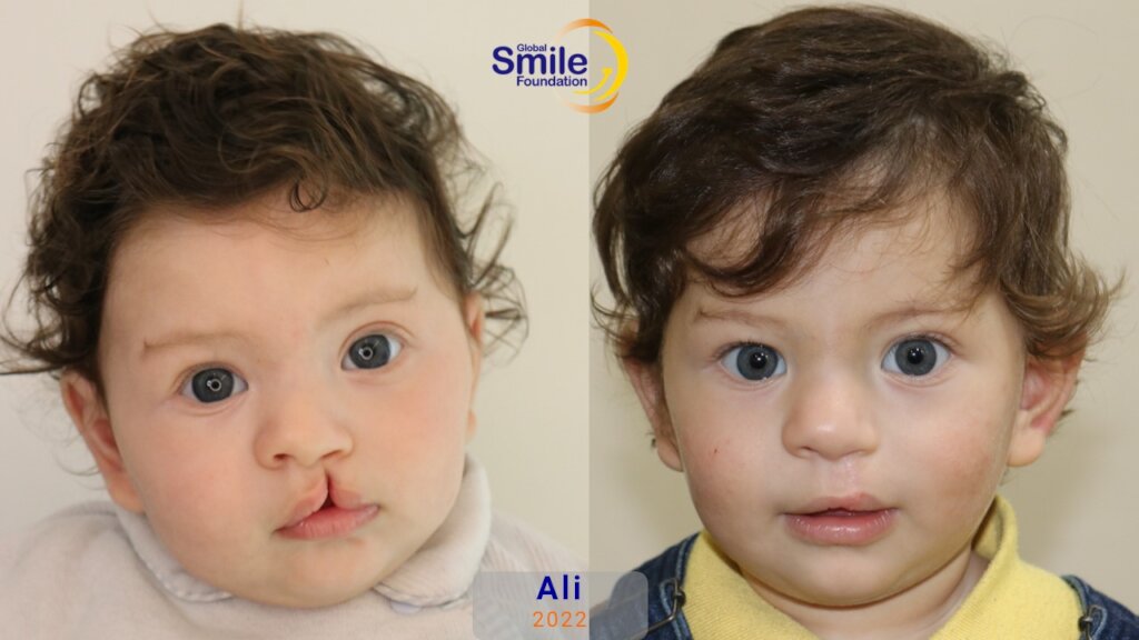 Ali's Healthy Smile