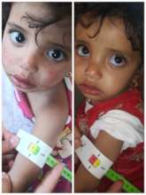 Child`s situation has improved