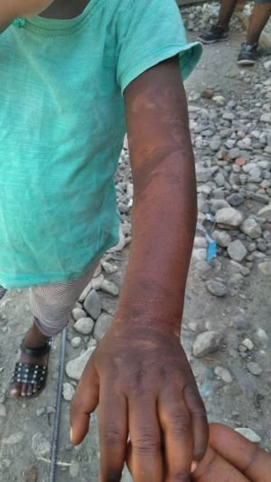 Hope for Better Health