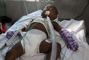 child after surgery