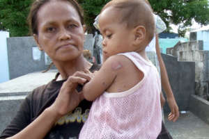 The child who has the skin problem and his mother