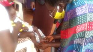Village Health Workers assess swelling of feet