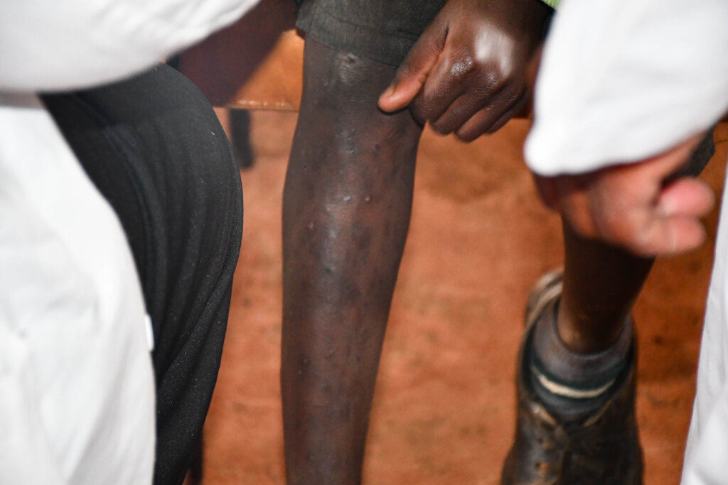PROVIDING HEALTHCARE TO CHILDREN IN RURAL KENYA