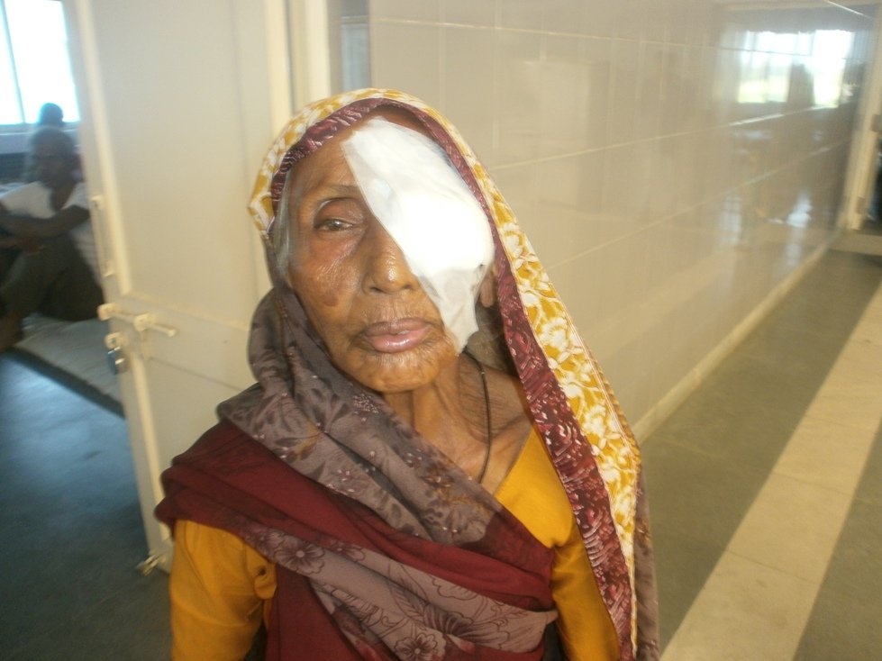 Smile on Face after Eye Surgery