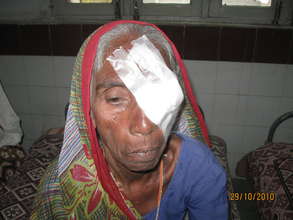 Beneficiary of Eye Surgery