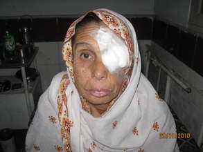 Beneficiary of Eye Surgery