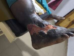 Lingsley - heavy cellulitis