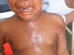 Oriema, a young girl suffering from bad water