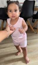 Emma- diagnosed with polydactyly