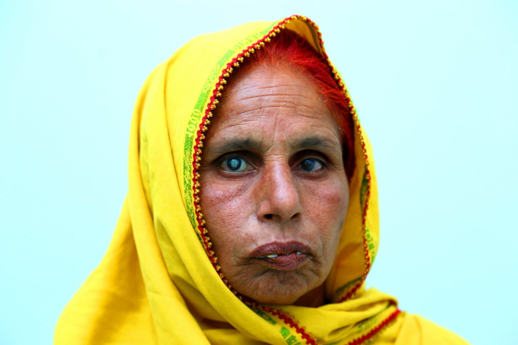 Free Cataract Surgeries of 3000 Poor Patients