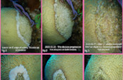 Stony Coral Tissue Loss Disease Intervention