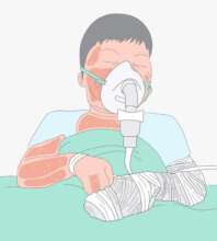 Nice received treatment from burns all over body.