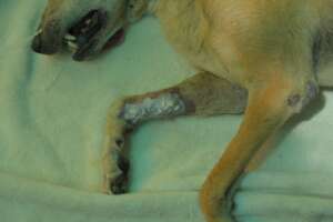 The tumour removed successfully