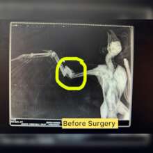 Kiko Before Surgery with the fracture