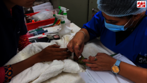 Check-up & cleaning of the bird's eye