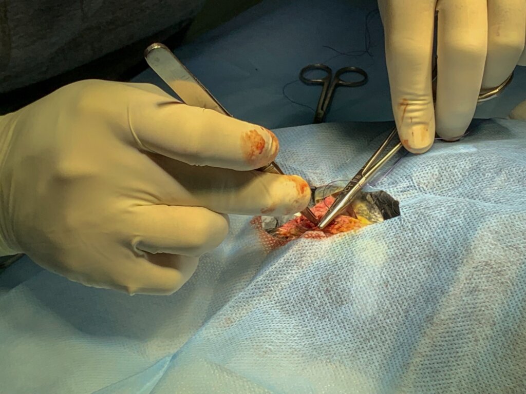 Raga is undergoing the surgery for its wound