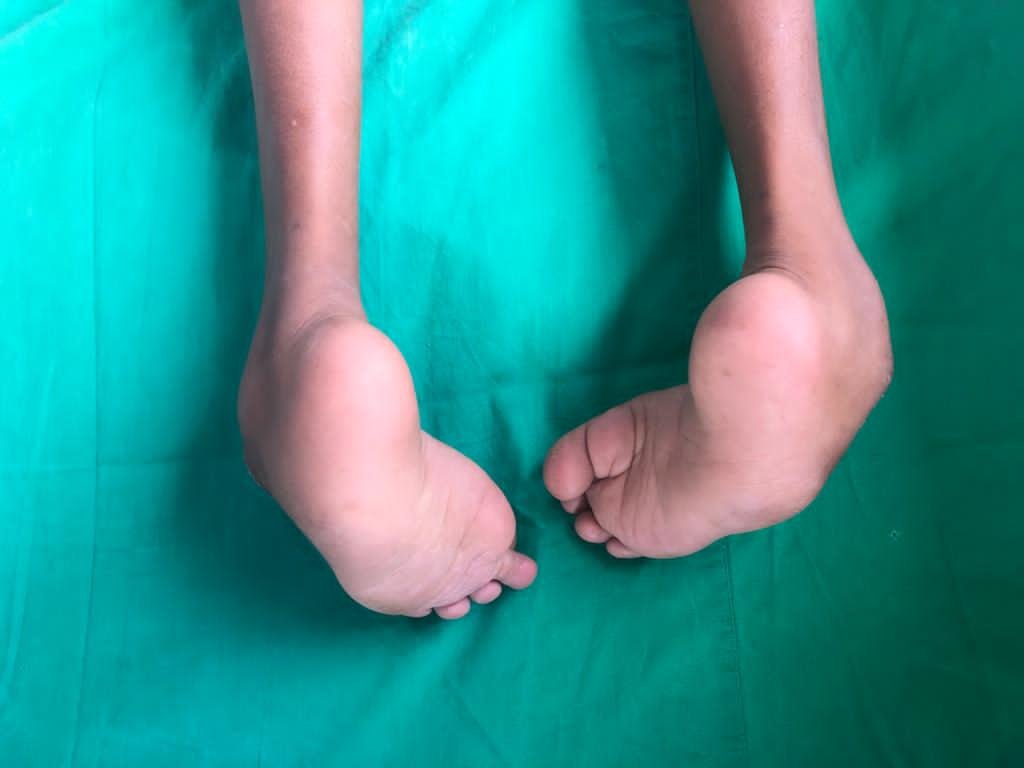 Urgent Medical Surgeries 4 Sri Lanka Children