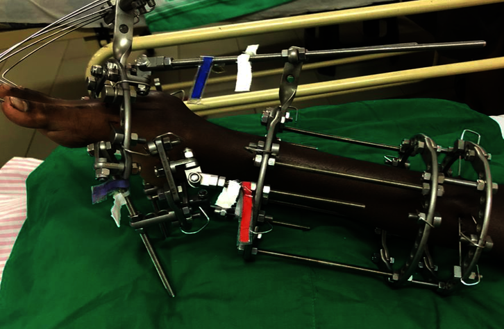 Urgent Medical Surgeries 4 Sri Lanka Children