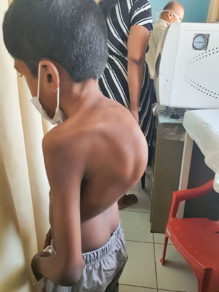 Urgent Medical Surgeries 4 Sri Lanka Children