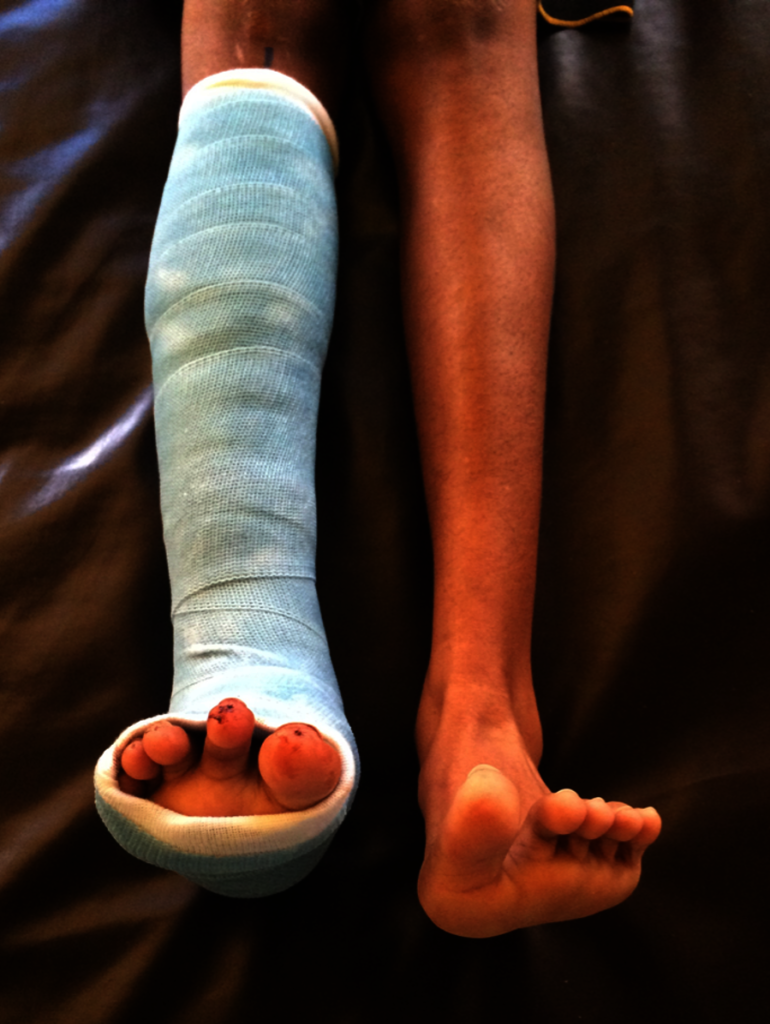 Urgent Medical Surgeries 4 Sri Lanka Children