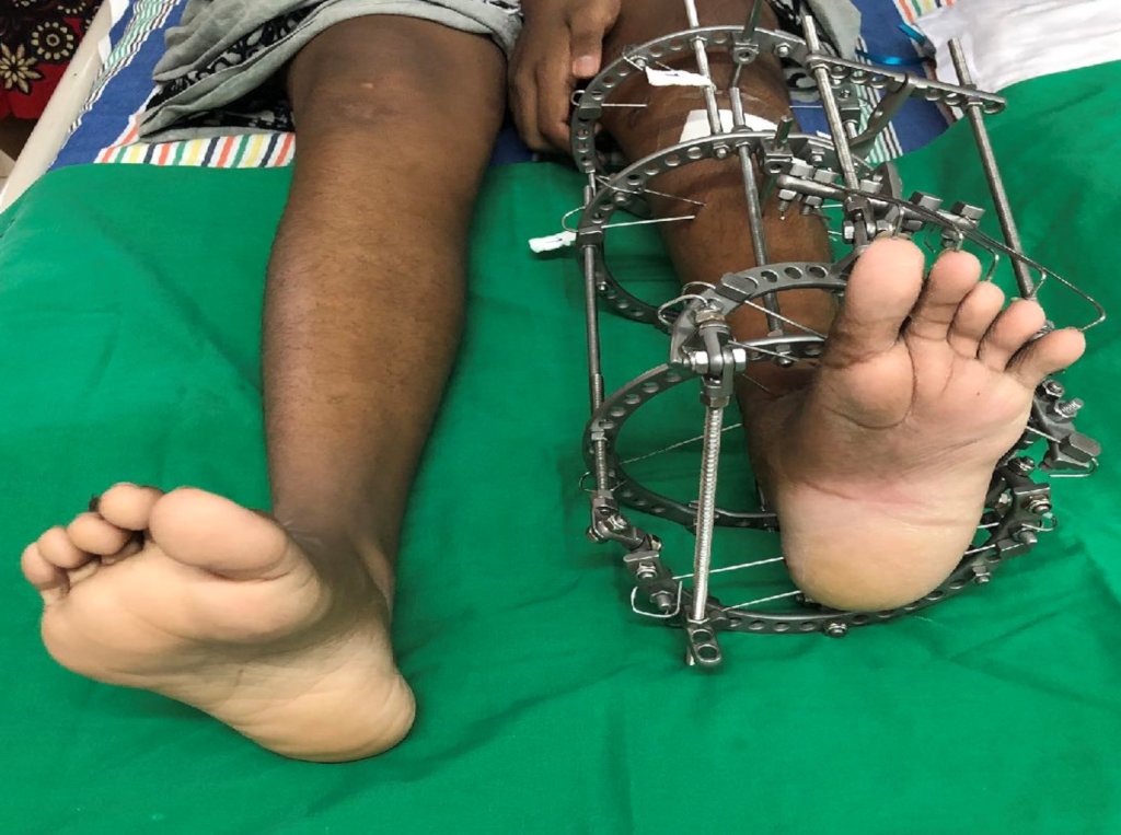 Urgent Medical Surgeries 4 Sri Lanka Children