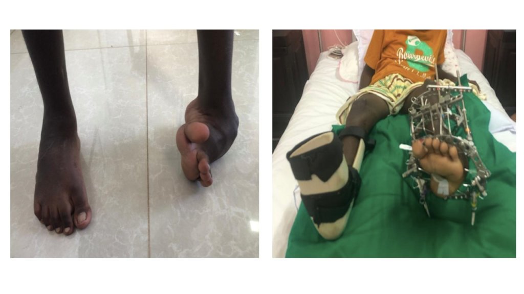 Urgent Medical Surgeries 4 Sri Lanka Children