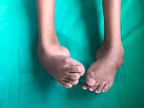 Little feet ...... waiting to walk