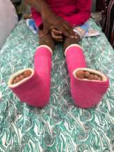 Little feet ..... being healed