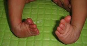 Please help me to walk.....