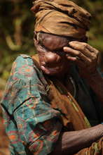 woman with a rare disease