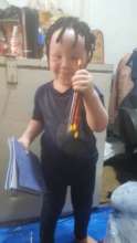 A girl with albinism happy with books and pencils