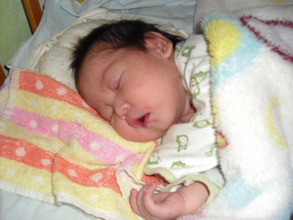 Little ZLY, pre-op