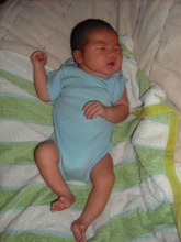 Infant JH (pre-surgical)