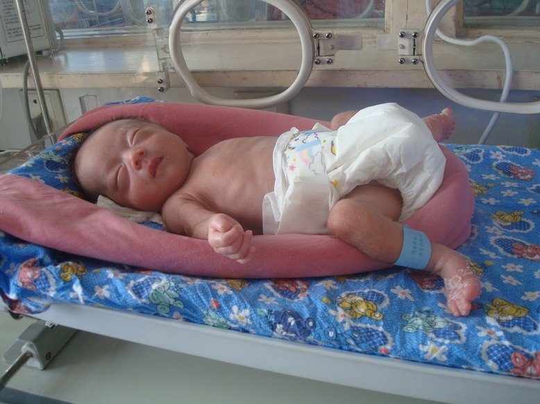 Fund critical surgery for 6 Chinese orphans