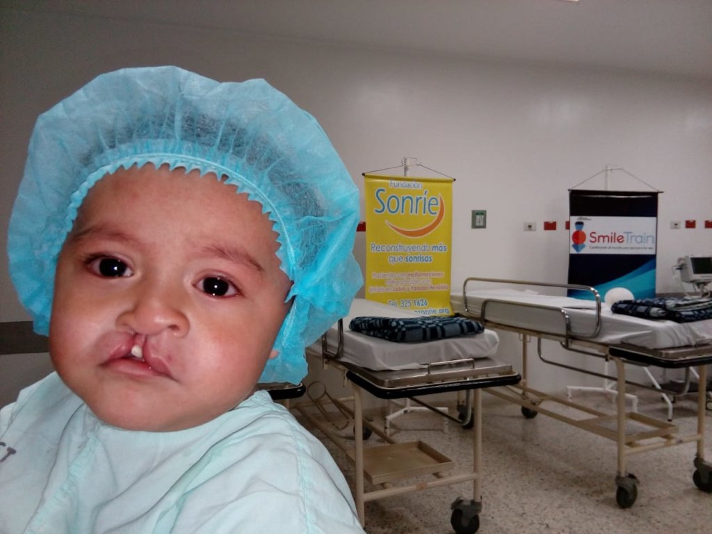 Helping kids with clefts to Smile again (Colombia)