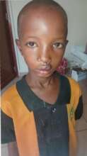Dawud pictured after surgery