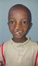 Dawud Pictured Before Surgery